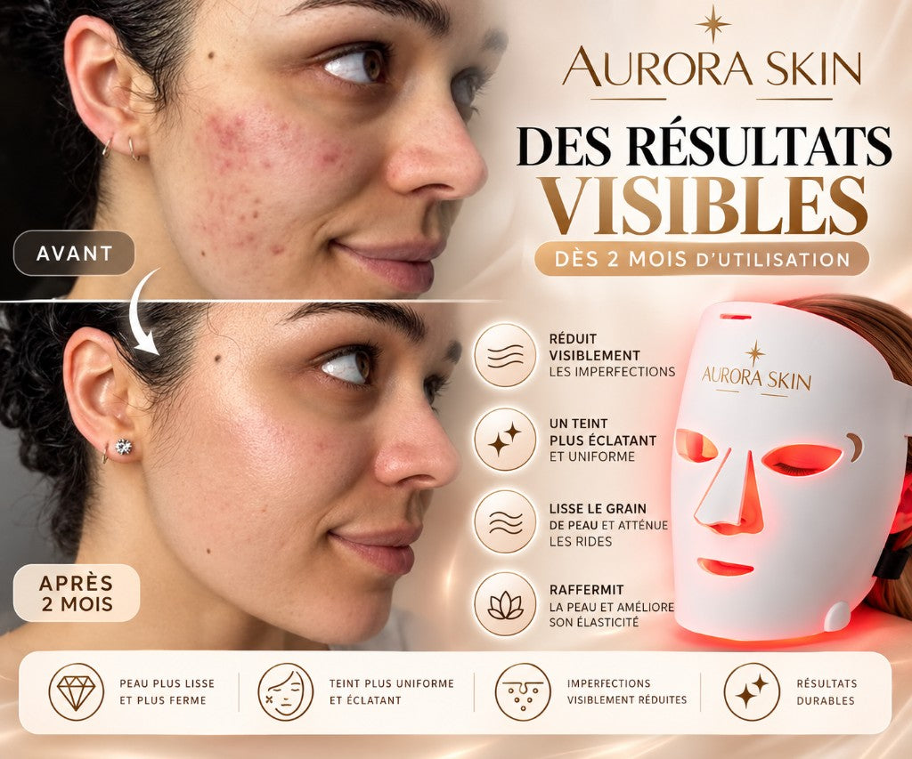 Résultats visibles Aurora Skin — avant / après